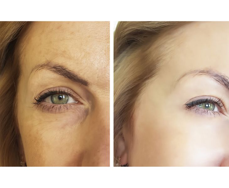 Benefits-of-Trifluoroacetyl-Tripeptide-2